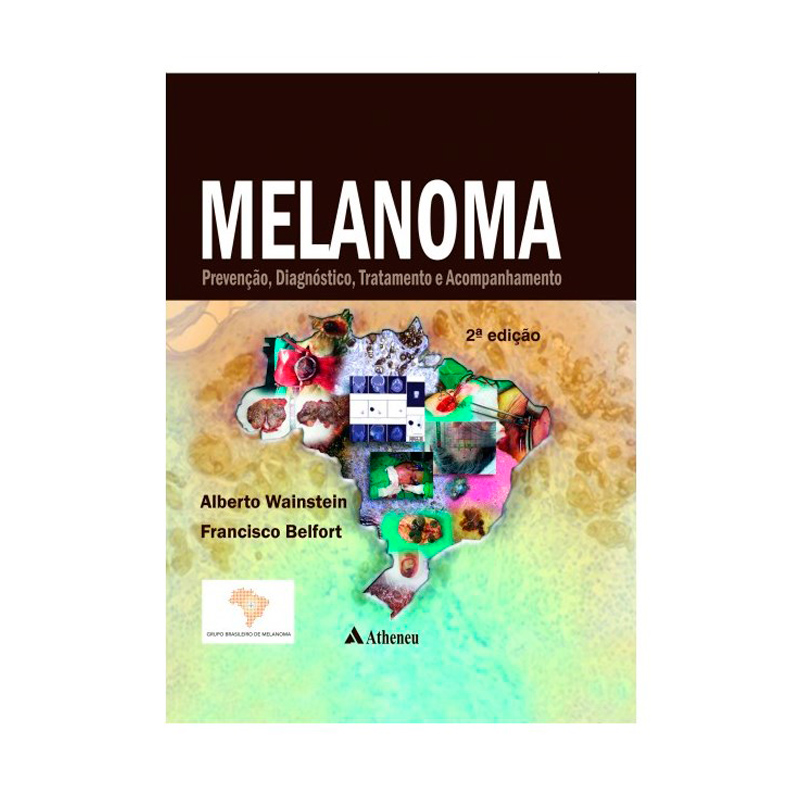 MELANOMA