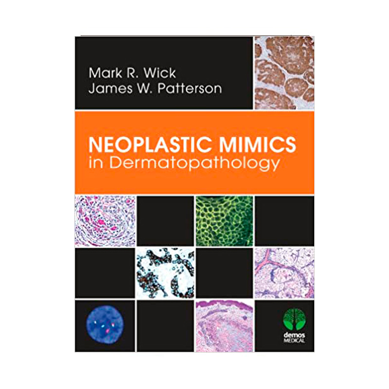 NEOPLASTIC MIMICS IN DERMATOPATHOLOGY