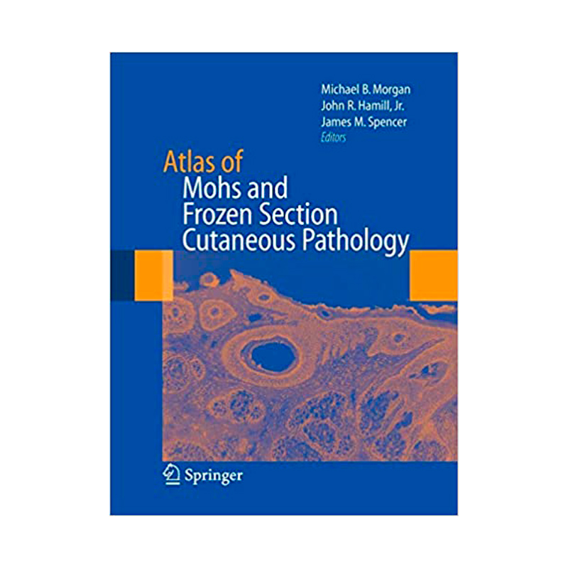 ATLAS OF MOHS AND FROZEN SECTION CUTANEOUS PATHOLOGY
