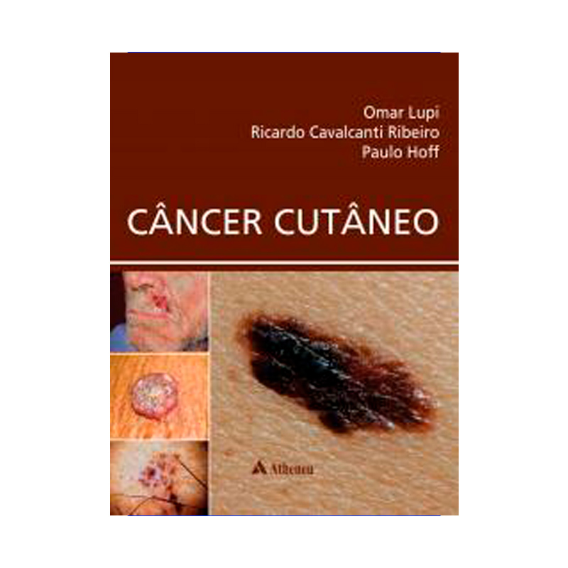 CÂNCER CUTÂNEO