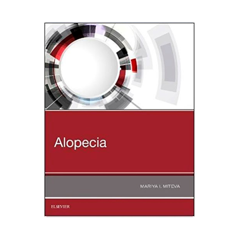 ALOPECIA