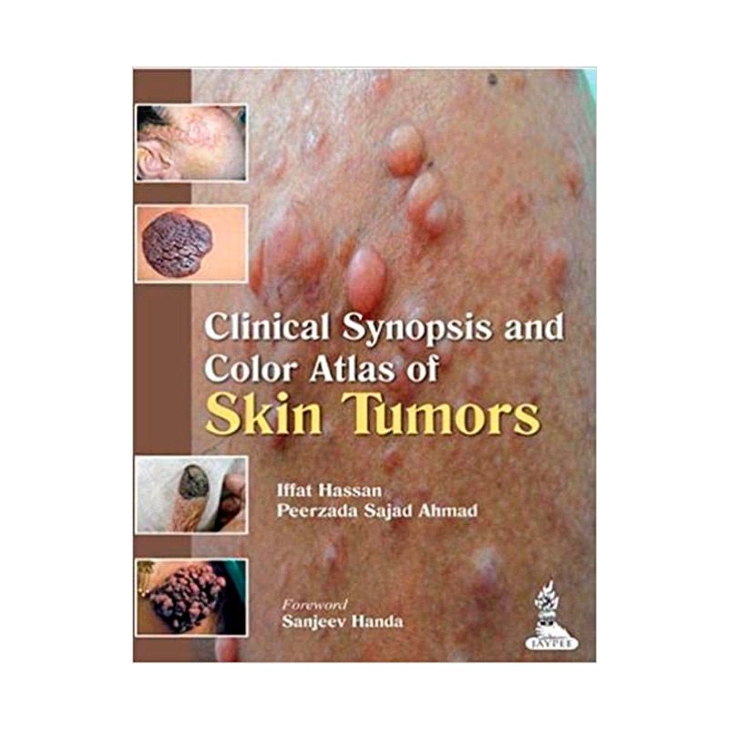 CLINICAL SYNOPSIS AND COLOR ATLAS OF SKIN TUMORS