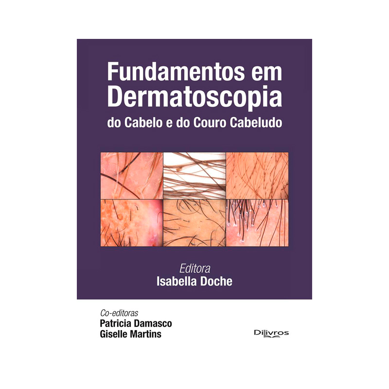 FUNDAMENTOS EM DERMATOSCOPIA DO CABELO E DO COURO CABELUDO