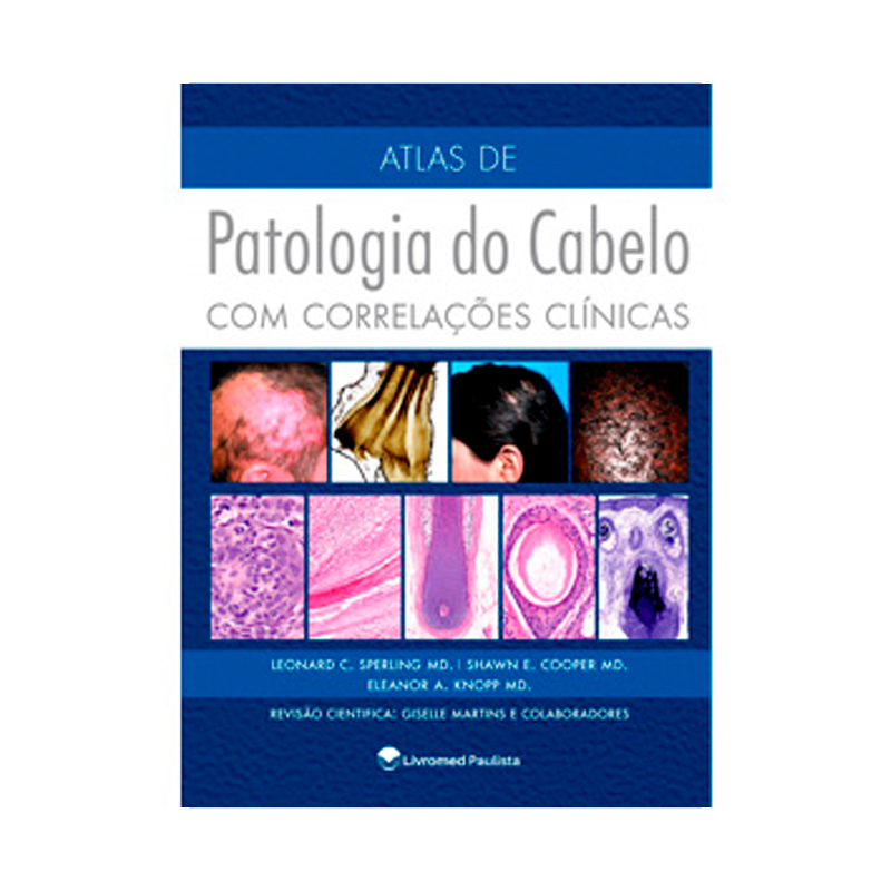 ATLAS DE PATOLOGIA DO CABELO COM CORRELAÇÕES CLINICAS